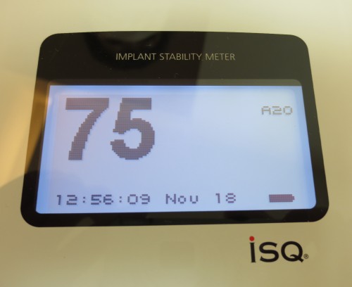 阿久井7　２次オペ時